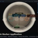 DICOM viewer and annotation software displaying diagnostic medical images for clinical review, treatment planning, and healthcare collaboration.